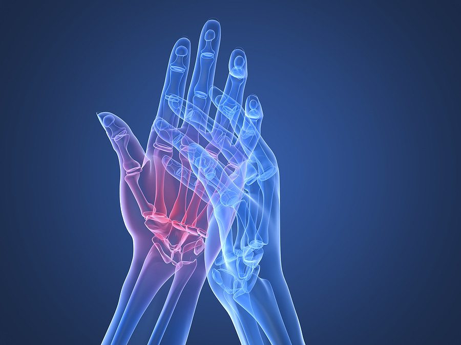 A kézízület sérülése, A kéz leggyakoribb betegségei - Súlypont Ízületklinika